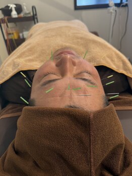 ファーストフォース鍼灸整体院 分倍河原店(1st. force鍼灸整体院)/美容鍼