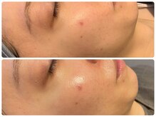 リノリー 古川店(rinory)/韓国セラピール