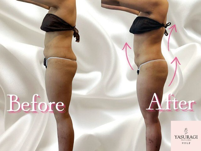 名谷駅でエンダモロジーが人気のエステサロン｜ホットペッパービューティー