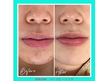 リレア ラカ(Relair Laka)の雰囲気(自らうるおう肌へ導くハーブピーリング体験)