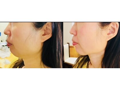 サロンモコ(Salon Moco)の写真