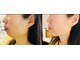 サロンモコ(Salon Moco)の写真