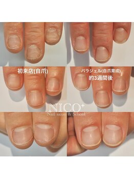 ニコプラス(NICO+)/自爪育成中