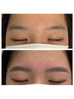 ラ フルール(La Fleur)/ハリウッドブロウリフト