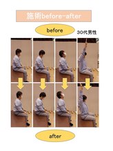 いみすぽ整体/30代男性ビフォアアフター