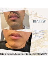 ムーモー 横浜関内店(mu_mo_)/ヒゲ脱毛