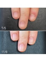 ネイルズ アヴァンティ(Nails Avanti)/自爪育成ネイルケア