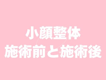 田端整体院/小顔整体/小顔矯正/伊勢崎/