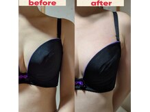 スノードロップ(snowdrop)/