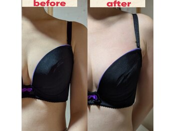 スノードロップ(snowdrop)/