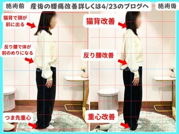 整骨院クリア 五香本院(整骨院Clear)の写真/【産後はいつまで経っても産後です】肩や腰、手首など産後の多く起こるその症状は骨盤からの姿勢が原因です