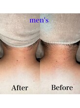 ミーエイト(Mii∞)/《襟足Before/After》