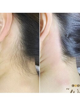 フー(woo)/うなじワックス