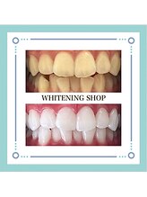 ホワイトニングショップ 福井店/1番人気☆フリーパスコース