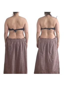 メリア(Mellia)/ラジオ波×筋膜×リンパ