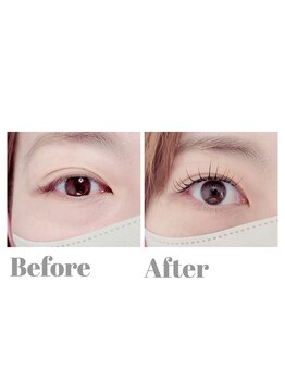 ジャスミン(jasmine)/エクパのbeforeAfter