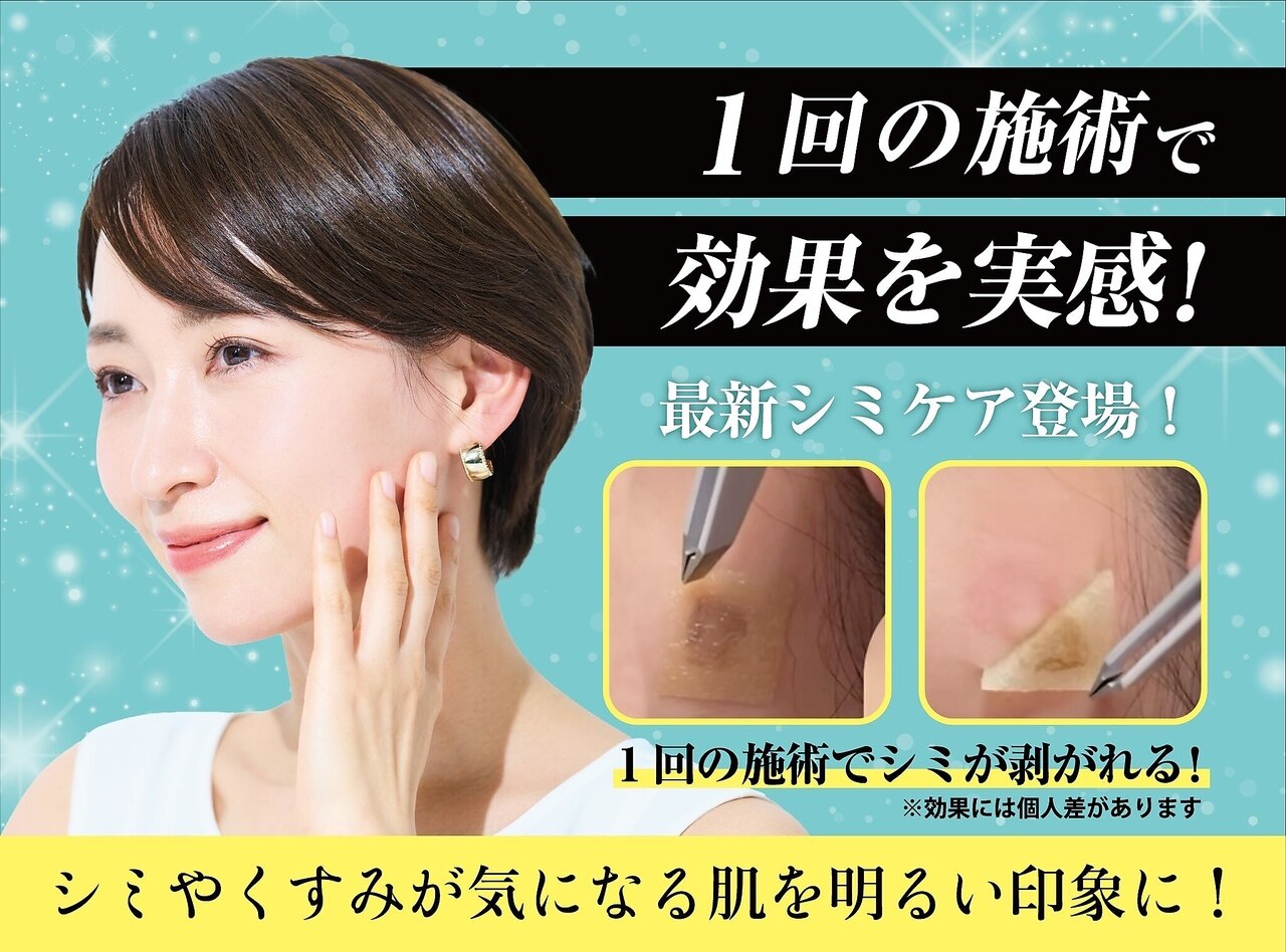 シミケア高松｜ホットペッパービューティー