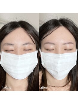 アイリー(IRIE)/HBL ハリウッドブロウリフト