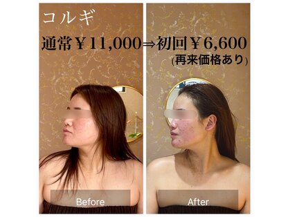 コンジュ(kongju)の写真