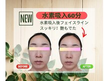ヨサパーク テマ 牛込柳町店(YOSA PARK tema)の雰囲気（痩身/よもぎ蒸し/リンパ/小顔/毛穴/ニキビ/シミ/ダイエット）