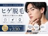 【メンズ】先着5名様限定!美肌最強☆ヒゲALL脱毛!破格の初回¥330!!