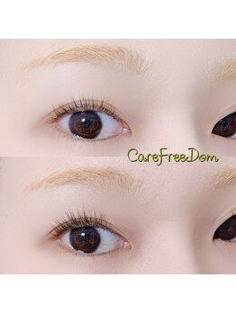 ケアフリーダム(CareFreeDom)/Citeラッシュリフト、ちょい足し