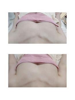 ユニクリア(Uni clear)/バストアップケア