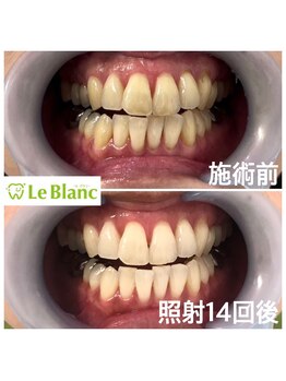 ルブラン 奈良店(Le Blanc)/気になった時に始めませんか？