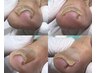 足のお爪で悩まれてる方!厚くて切れない、痛みがある、まずはご相談ください!