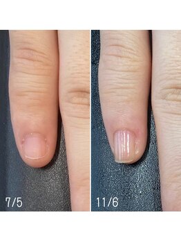 自爪育成ネイルケア