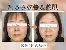 ル シェノン(Le Chainon)