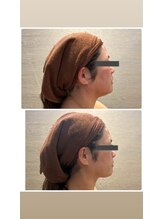 バンブー B2 新涯店(Bamboo)/フェイシャルグラヴィティ1回