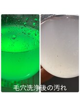 スキンラボ カホクカイ(KaHokuKai)/初回