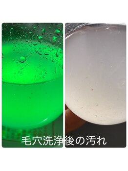 スキンラボ カホクカイ(KaHokuKai)/初回