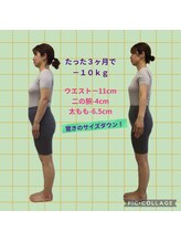 よこた針灸整骨院/腰の反り