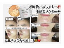 ホワイトアクア 加古川店(WHITE AQUA)/ハーブピーリングで肌荒れ改善