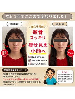 すみ治療院の写真/黄金比で叶える立体フェイス★秋田で希少な小顔ソムリエが骨格から整え、スッキリしたフェイスラインへ◎