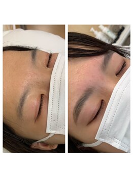 ラ フルール(La Fleur)/ハリウッドブロウリフト