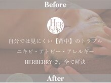 ハーバリー ハーブピーリング 岐阜(HERBERRYハーブピーリング)/ハーブピーリング専門店HERBERRY