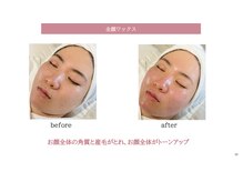 ジョリー(JOLi)/【7月導入予定】韓国美肌WAX