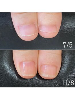 ネイルズ アヴァンティ(Nails Avanti)/自爪育成ネイルケア
