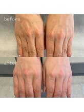 シャルム ド ネイルズ(Charm de nails)/