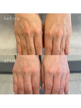 シャルム ド ネイルズ(Charm de nails)/