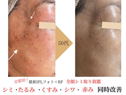 エソア(esoa)の写真