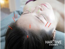 ハリティブ(HARITIVE)