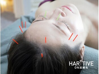 ハリティブ(HARITIVE)の写真/【完全個室でリラックス◎】女性鍼灸師による鍼灸×極上ヘッドスパで眼精疲労・頭痛＋首肩コリを根本改善!!