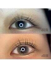 トラスト(Trust)/1回目→5回目の効果◎