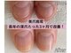 シーネイル(C Nail)の写真