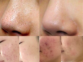 シャルトルズ 西宮北口店