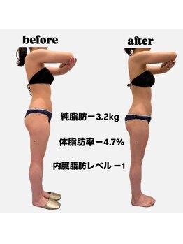 シャルム(CHARME)/代謝上げインディバ